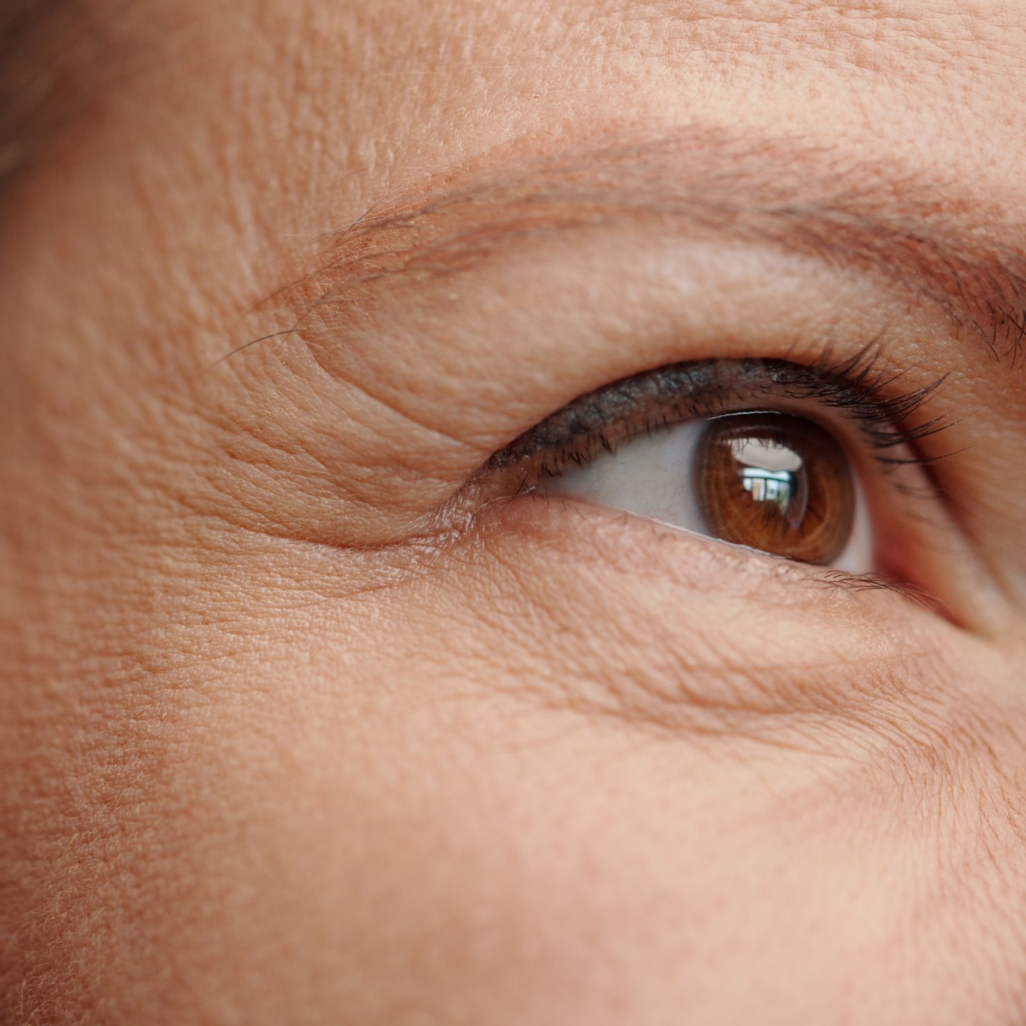 vrásky v okolí očí